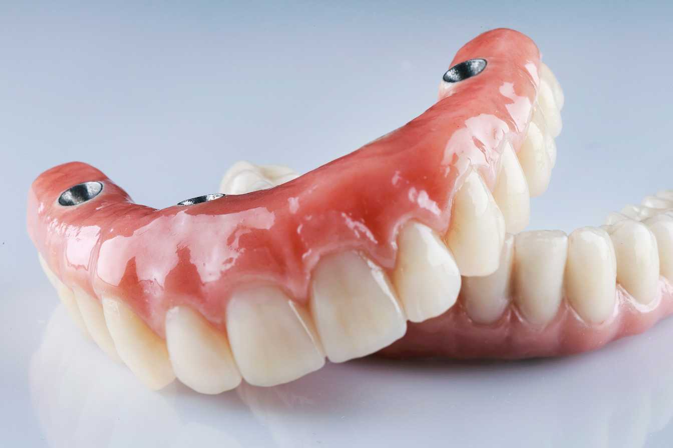 dents-en-resine-capdentaire-3