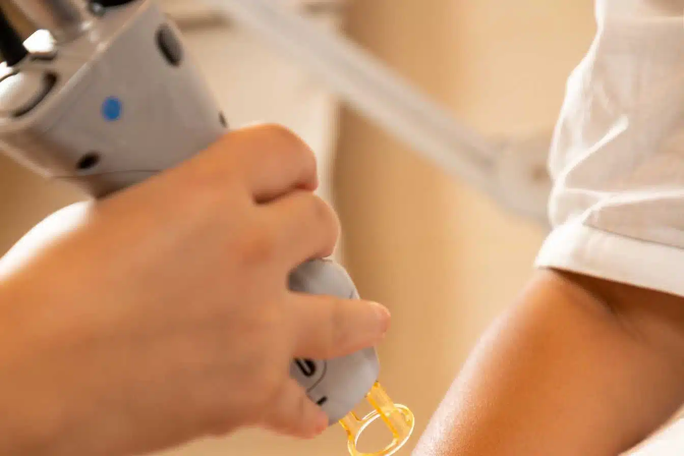 epilation laser maison du laser ce qu il faut savoir avant de reserver 1