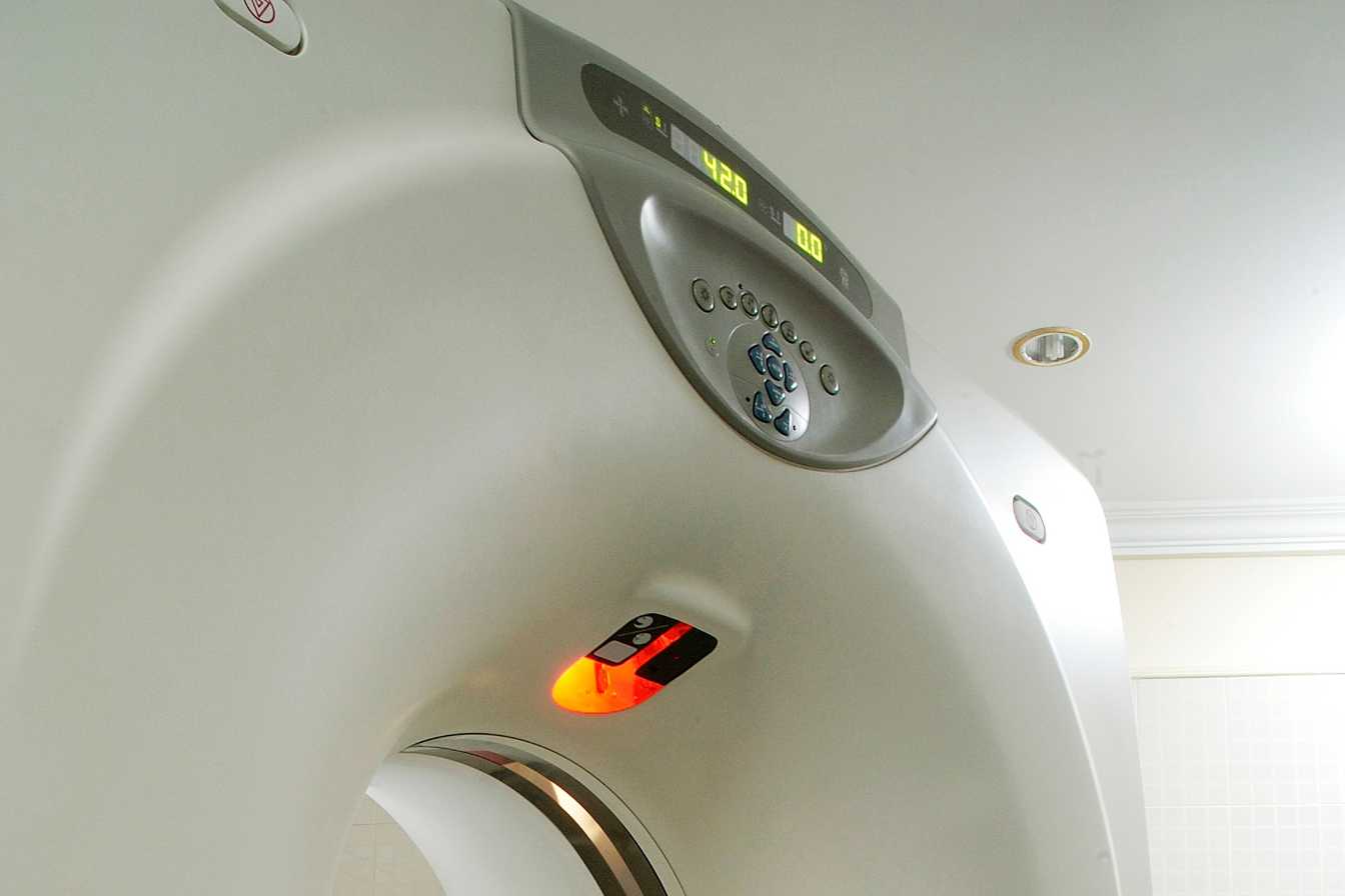 irm-et-sclerose-en-plaques-comment-cet-examen-detecte-et-suit-la-maladie-2